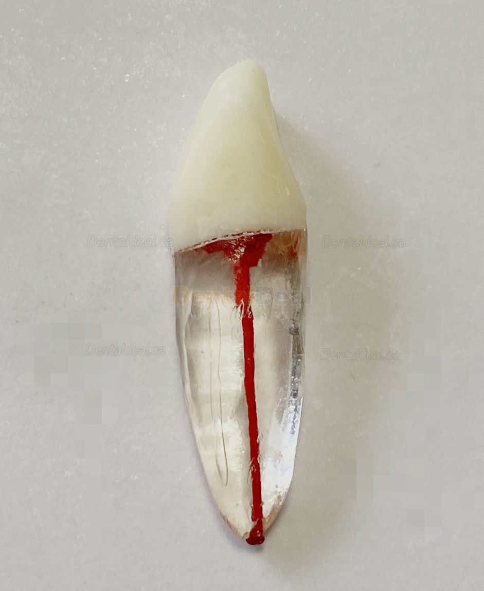 Dental Teeth Practice Model Endo File Molar Upper Lower Tooth Premolar Root 2/3-Rooted Canal